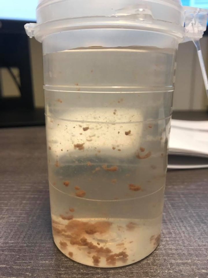 Nước giếng khoan nhiễm phèn